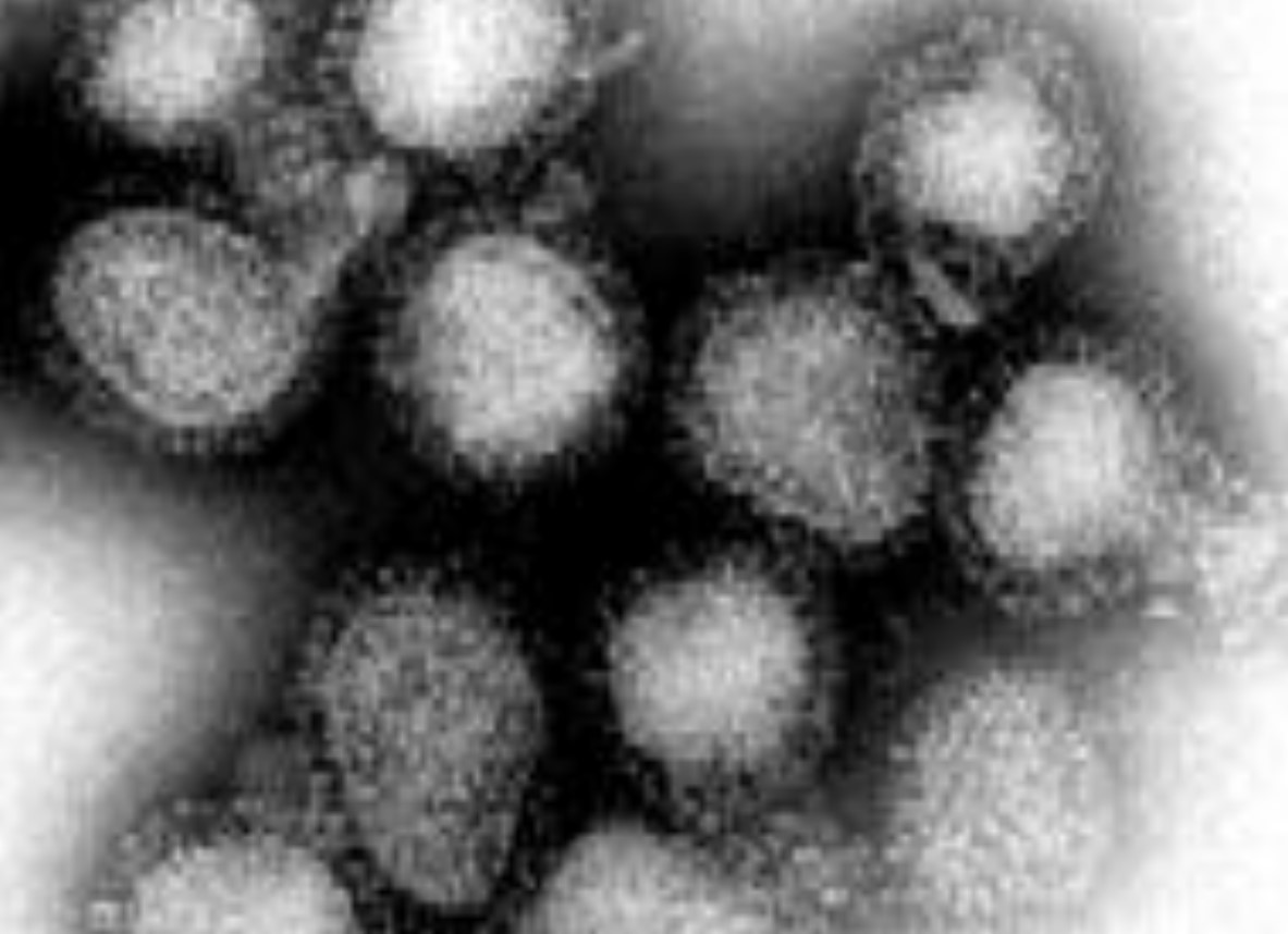 На Сахалине выявлен первый случай гонконгского гриппа