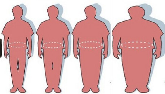 Врачи из РФ сталкиваются с увеличенным количеством случаев ожирения у пациентов