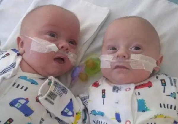 32-летняя британка родила самых маленьких близнецов в мире