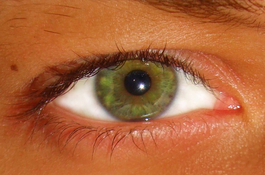 Врач Стоянова: покраснение одного глаза может являться ранним признаком развивающейся глаукомы