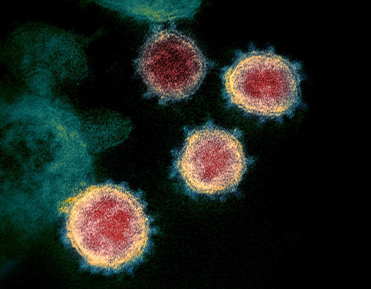 Невидимые угрозы: какие вирусные инфекции все еще представляют угрозу человечеству