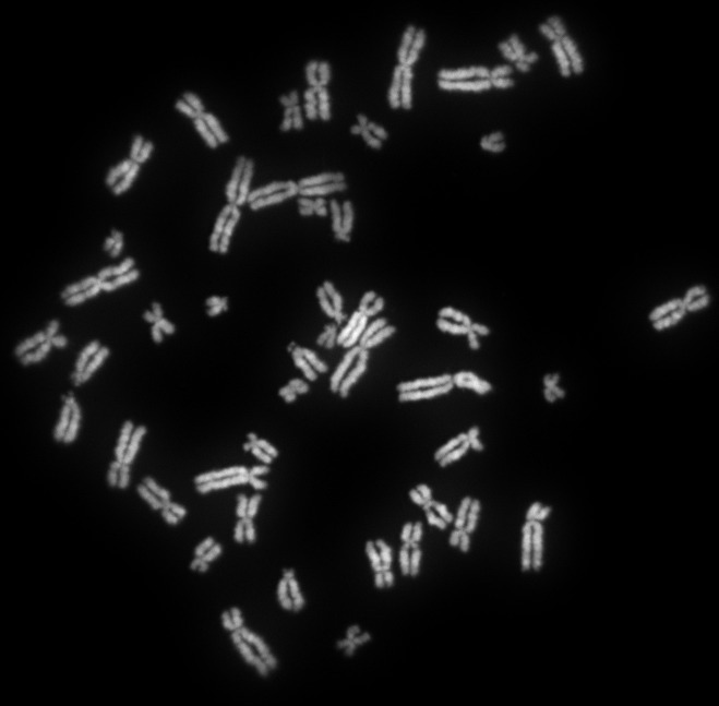 Генетик Крутовский объявил, что Y-хромосома, определяющая мужской пол, может в будущем исчезнуть