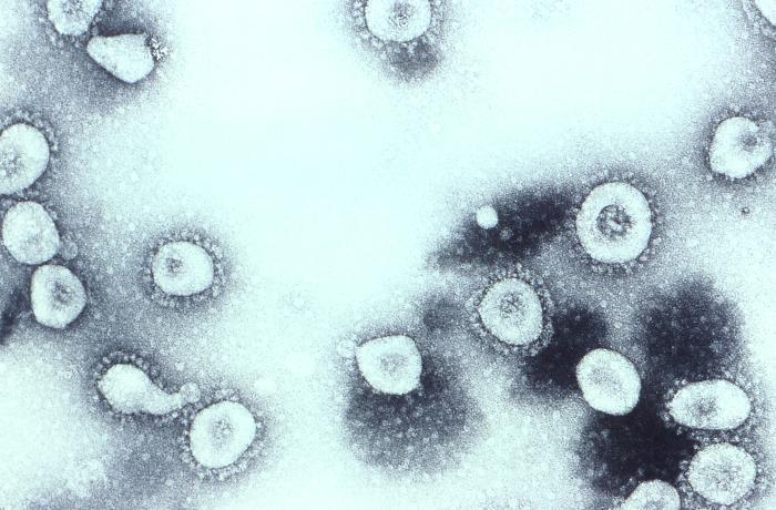 Американские ученые обнаружили простой метод лечения тяжелой формы коронавируса