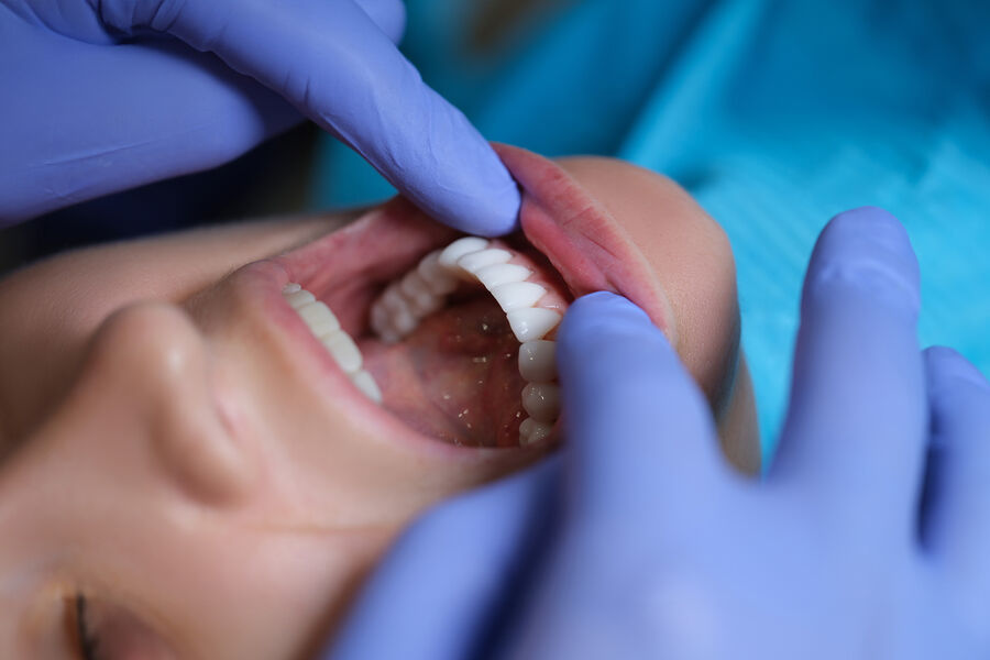 Стоматологи стали больше пользоваться спросом у россиян