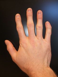 Ученые из Канады предлагают новый метод определения психопатии — анализ длины пальцев