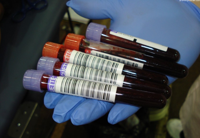 Специалист Стефанюк раскрыла процесс обработки крови от людей, впервые решившихся на донорство