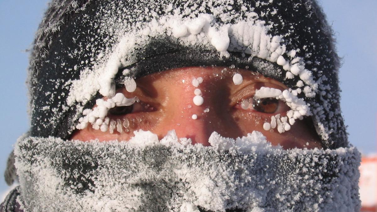 Frozen face of wintering personnel during first Dome C winterover Frozen face of wintering personnel during first Dome C winterover