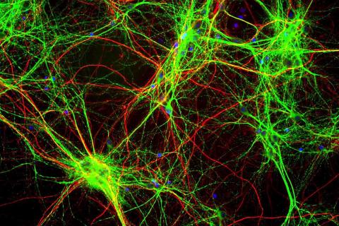 UCSF: иммунные клетки мозга играют ключевую роль в развитии интернейронов у человека