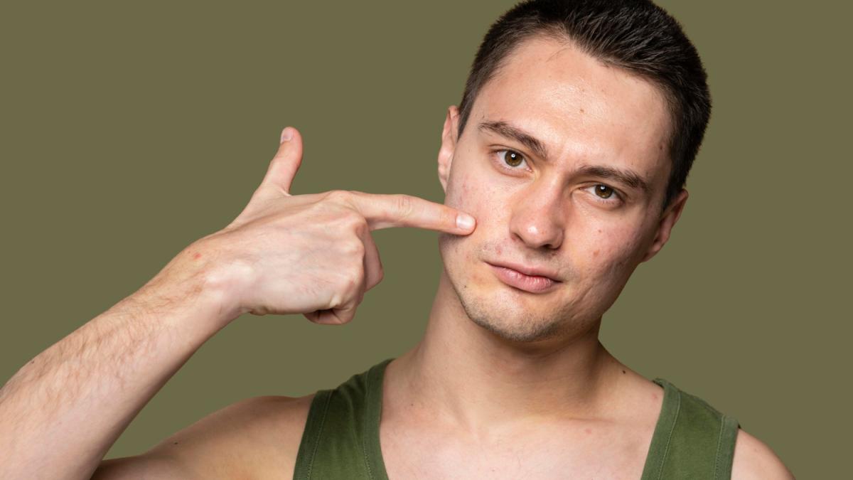 Прыщи у мужчины