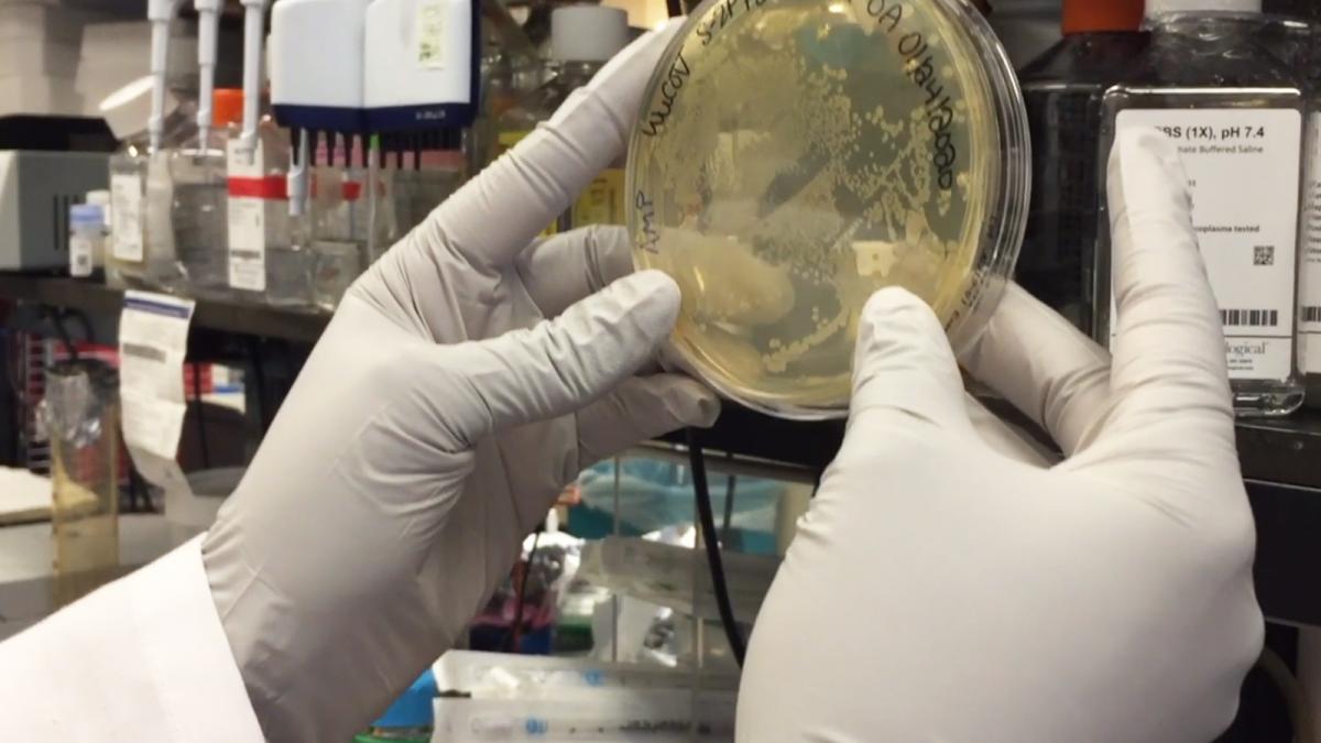 COVID-19 vaccine agar plate COVID-19 vaccine agar plate