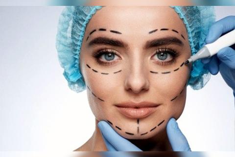 Подтяжка лица через рот не даёт эффекта омоложения – хирург Амжад Аль-Юсеф