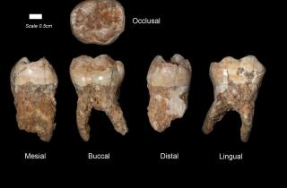 Гормоны в зубах выявили беременность у средневековых женщин — Барлоу