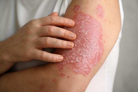 Гликокаликс управляет поведением иммунных клеток и воспалением организма — Эми Сондерс, Дуглас Дайер