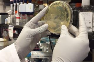 Микротромбы связаны с длительным COVID-19 — подтвердили учёные из Монпелье