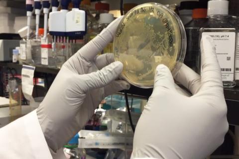 Микротромбы связаны с длительным COVID-19 — подтвердили учёные из Монпелье