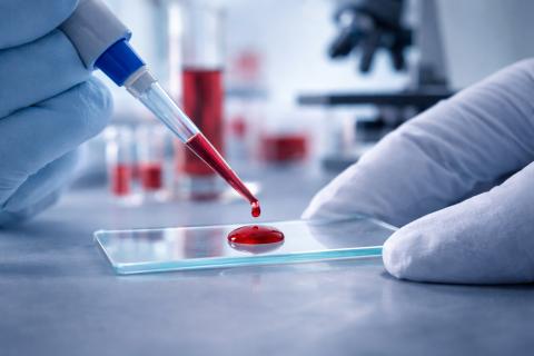 Кровь хранит опасное наследство: один ген повышает холестерин в 5 раз и разрушает сосуды