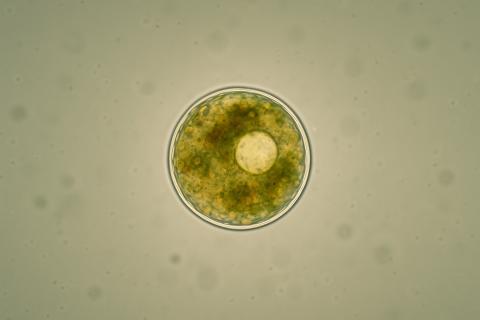 Меланин гриба из Чернобыля преобразует радиацию в энергию роста — Metro