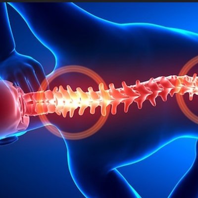 Эксперты проанализировали рекомендованную Илоном Маском операцию против боли в спине