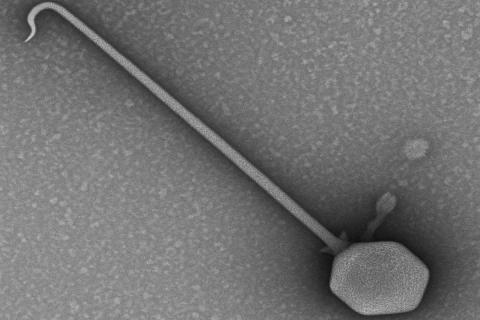 Французские учёные описали гигантский вирус PelV-1 с хвостом в 19 раз длиннее коронавируса