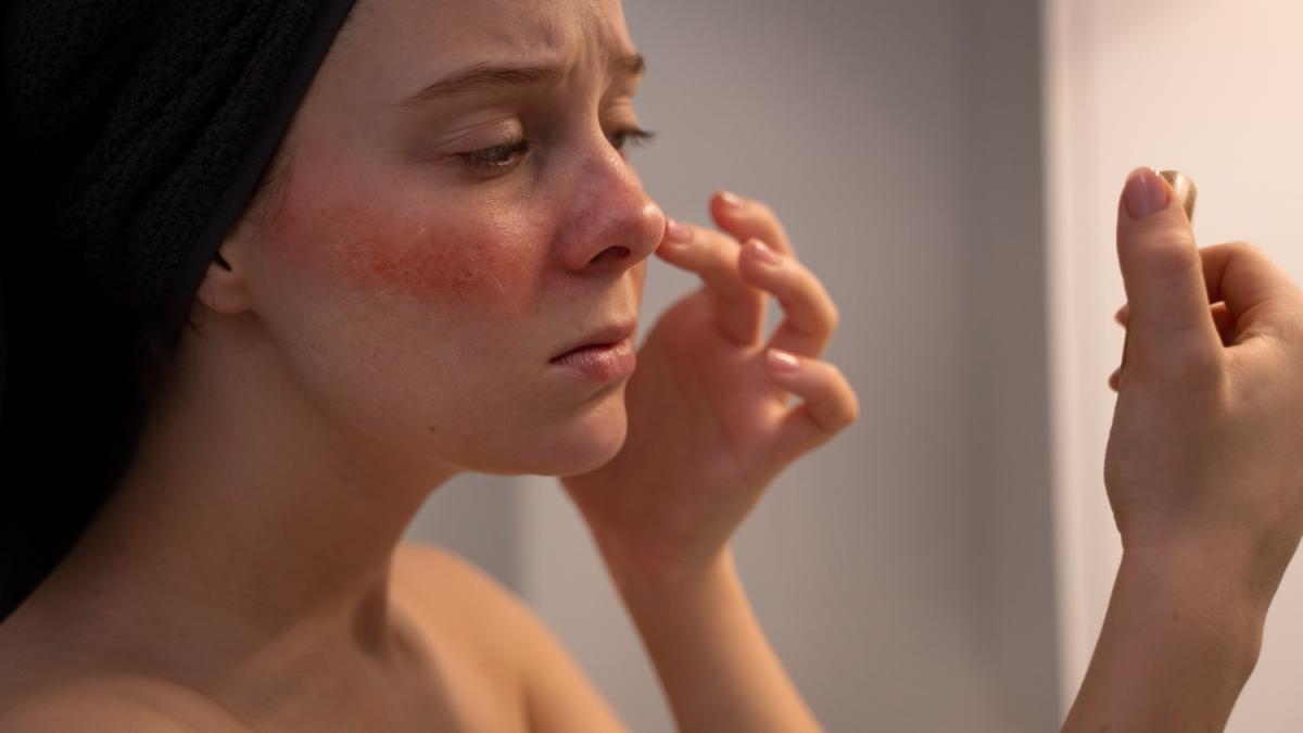 Девушка с аллергией Девушка с аллергией