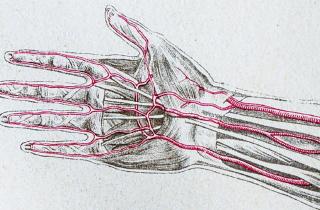 Артерии теряют эластичность при неправильном питании — кардиолог Мариньо