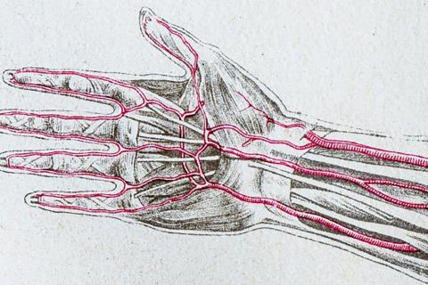 Артерии теряют эластичность при неправильном питании — кардиолог Мариньо