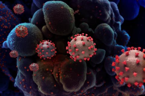 В России после пандемии увеличилось число неврологических и суставных заболеваний — Елена Ржевская