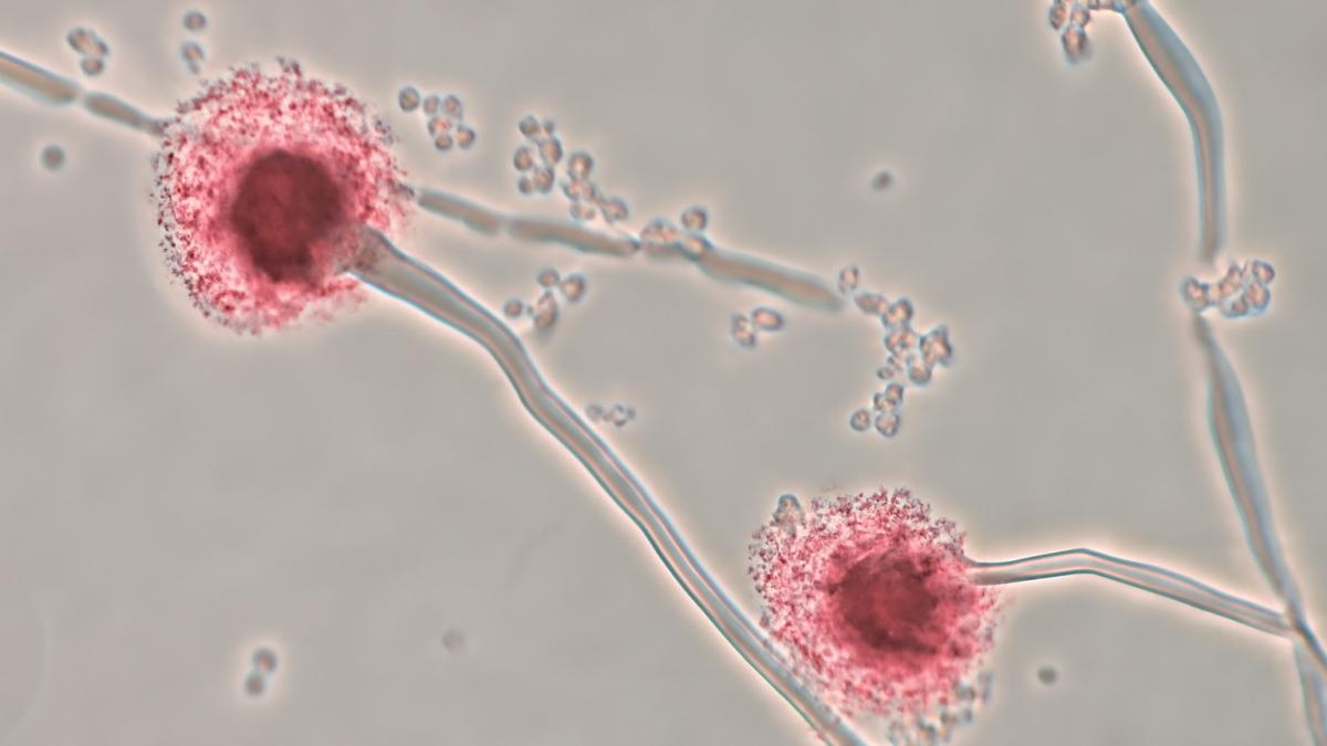 Микроскопическая фотография гриба Aspergillus