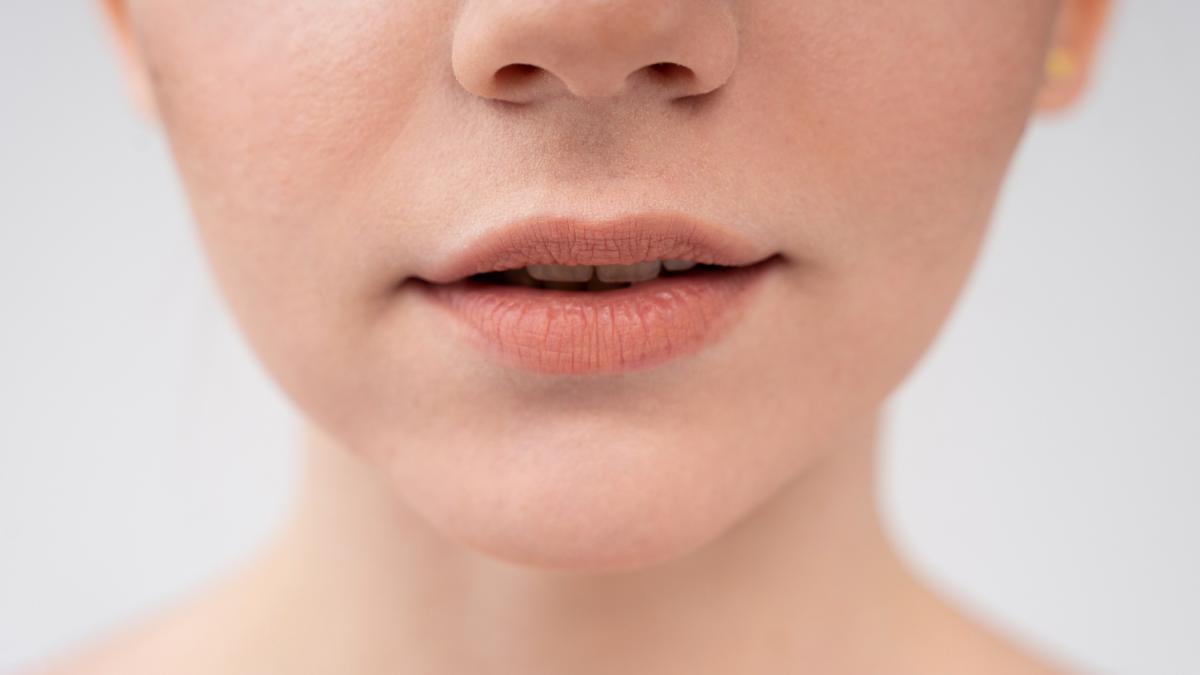 Девушка с сухой кожей губ