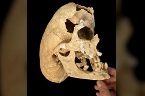 Мужчина с синдромом Крузона служил в ордене Калатрава — Heritage