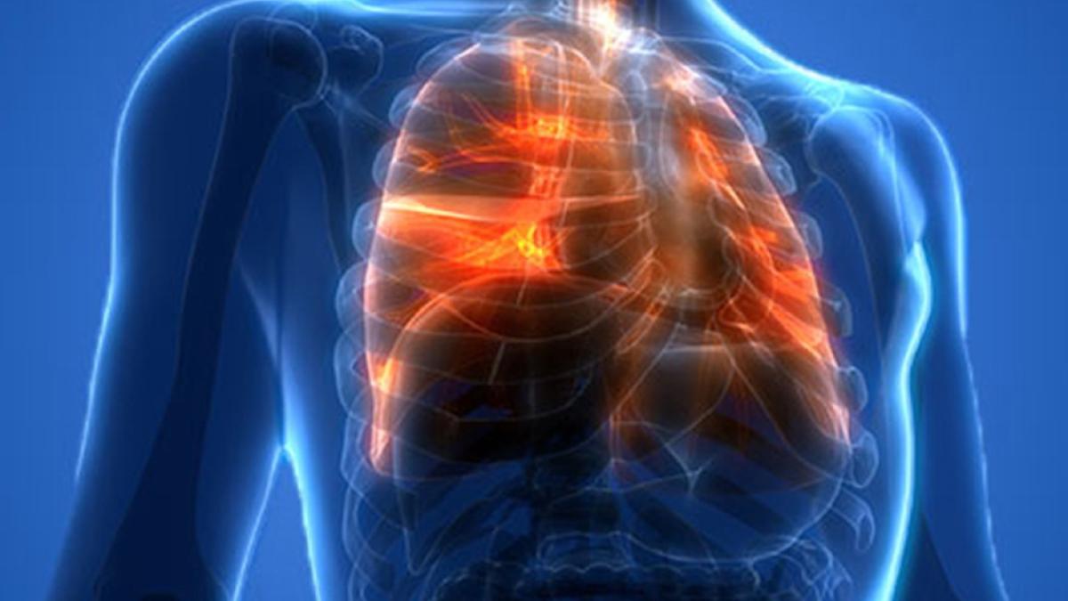 Больные лёгкие Больные лёгкие