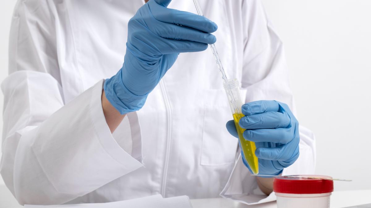 Анализ мочи