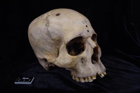 Найденный в Италии череп возрастом 12 600 лет подтверждает культурные практики деформации головы