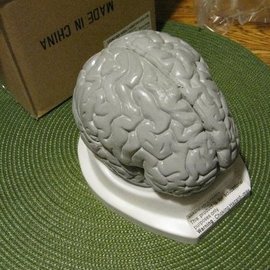 В ходе недавнего исследования ученые обнаружили увеличение объема мозга у людей в течение XX века
