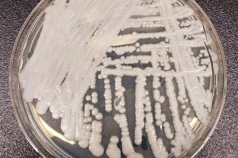 Candida auris атакует мозг: новые данные об опасном грибке