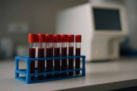 Врач-терапевт Ярцева: прием пищи перед сдачей крови искажает результаты анализов