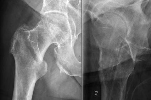 Сложные погодные условия и алкоголь увеличивают количество травм в новогодний период — Алексей Коваленко