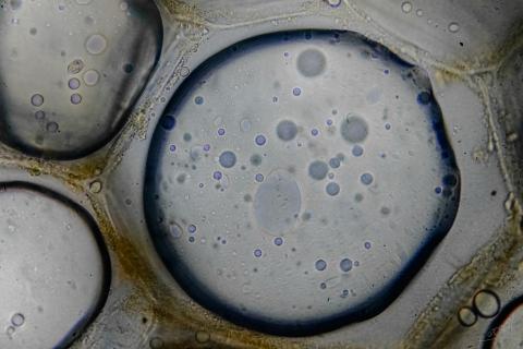 Белок SKL1 оказался ключевым для перехода растений из воды на сушу