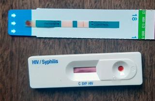 Поздние стадии сифилиса нередко выявляют из-за слабых симптомов — дерматолог Наталья Махнева