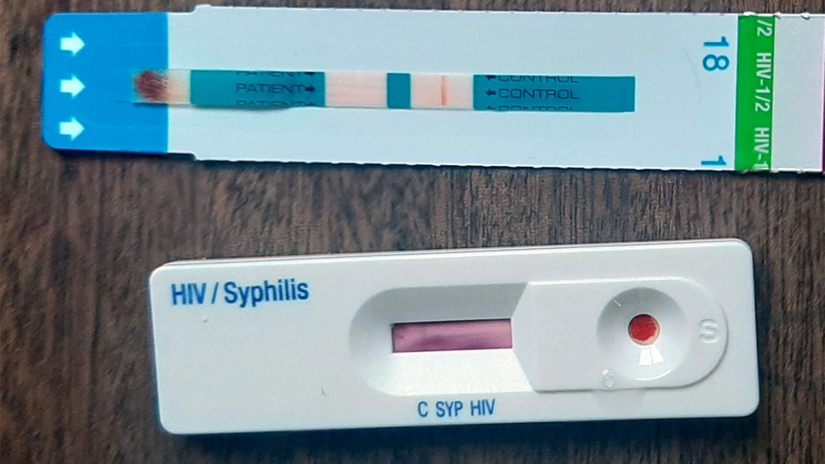 Тест на ВИЧ/сифилис