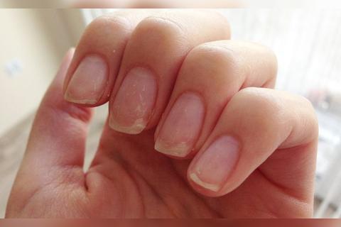 Как укрепить слоящиеся ногти: 5 советов для здоровья и красоты