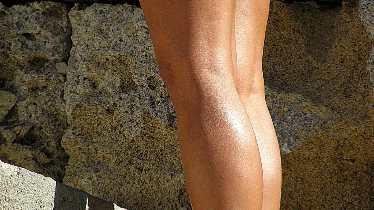 Женские ноги с варикозом