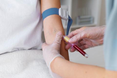 Учёные нашли микропластик в бляшках у 60% пациентов