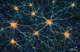 Связь двух зон мозга блокирует действие при стрессе — Current Biology