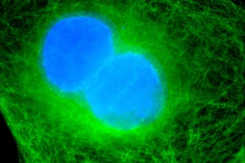 Первые клинические испытания терапии диабета 1 типа с модифицированными клетками прошли успешно