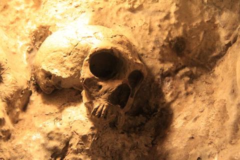 Научное открытие: рак существовал у людей 1700 лет назад, подтверждено анализом костей