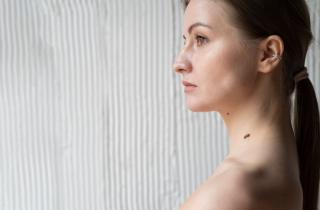 Красные родинки можно безопасно удалить с помощью лазерной терапии или криодеструкции — Алина Никифорова