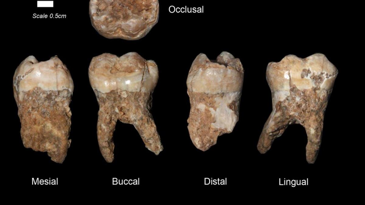 зубы, челюсти