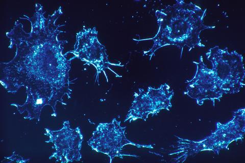 Учёные: нарушение микрофлоры снижает выживаемость при онкологии на фоне иммунотерапии