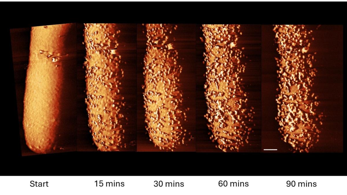 Снимок, демонстрирующий, как антибиотик убивает бактерии в реальном времени